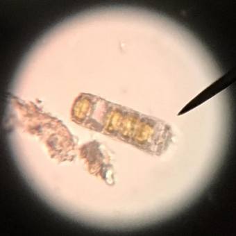 SFU Biology - A Diatom